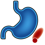 Kapselinhalt wird im Darm frei Kapselinhalt wird im Darm frei