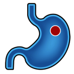 Kapsel erreicht Magen Kapsel erreicht Magen