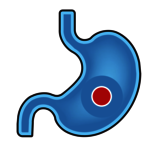 Kapsel im Magen Kapsel im Magen